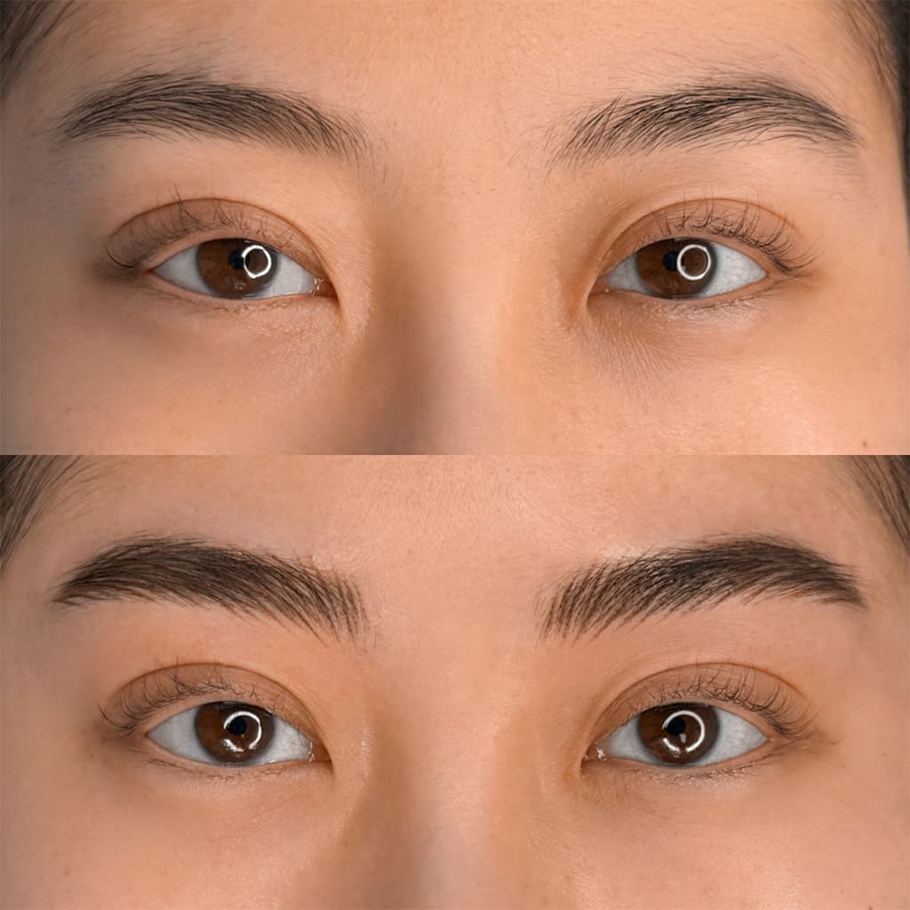 Presis nano-teknikk for bryn Presis nano-teknikk for bryn